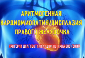 Внезапная сердечная смерть. Фокус на аритмогенную дисплазию правого желудочка