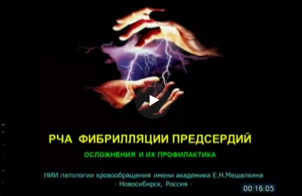 Осложнения катетерной аблации фибрилляции предсердий Осложнения катетерной аблации фибрилляции предсердий