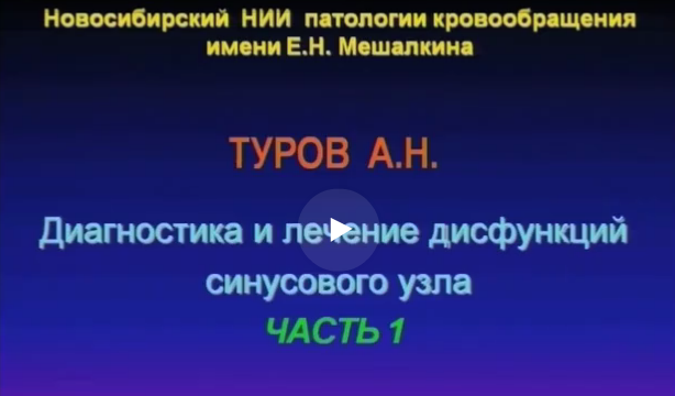 Современные представления о показаниях к имплантации ЭКС Современные представления о показаниях к имплантации ЭКС