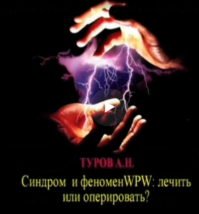 Cиндром и феномен Вольфа-Паркинсона-Уайта: лечить или оперировать? Cиндром и феномен Вольфа-Паркинсона-Уайта: лечить или оперировать?