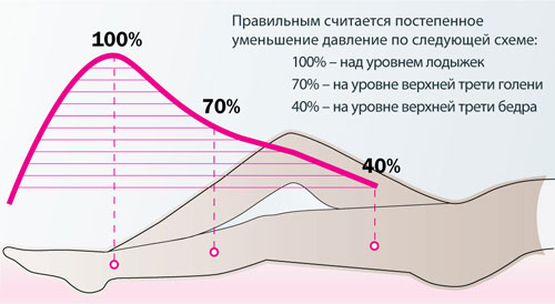 Лечебный трикотаж со знаком качества RAL-GZ 387 создает физиологически распределенное давление, постепенно снижающееся в направлении от лодыжек к бедру. Убывающий градиент давления стимулирует отток венозной крови от ног к сердцу, обеспечивая высокую медицинскую эффективность трикотажа. Лечебный трикотаж со знаком качества RAL-GZ 387 создает физиологически распределенное давление, постепенно снижающееся в направлении от лодыжек к бедру. Убывающий градиент давления стимулирует отток венозной крови от ног к сердцу, обеспечивая высокую медицинскую эффективность трикотажа.