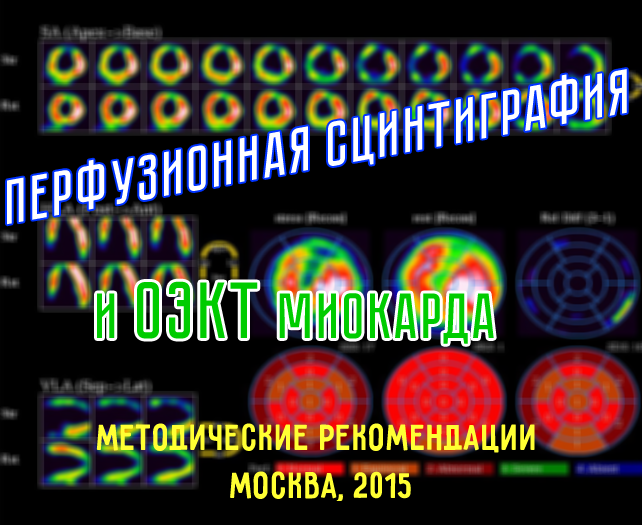 Перфузионная сцинтиграфия и ОЭКТ миокарда (Методические рекомендации. Москва, 2015) Перфузионная сцинтиграфия и ОЭКТ миокарда (Методические рекомендации. Москва, 2015)