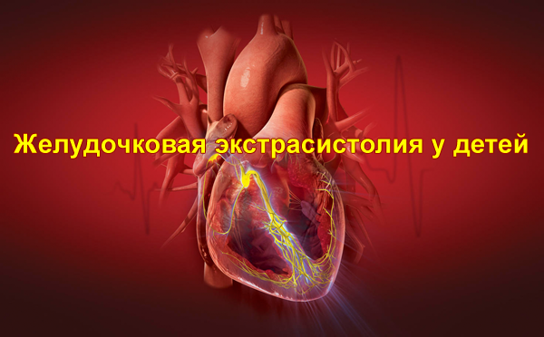 Желудочковая экстрасистолия у детей Желудочковая экстрасистолия у детей