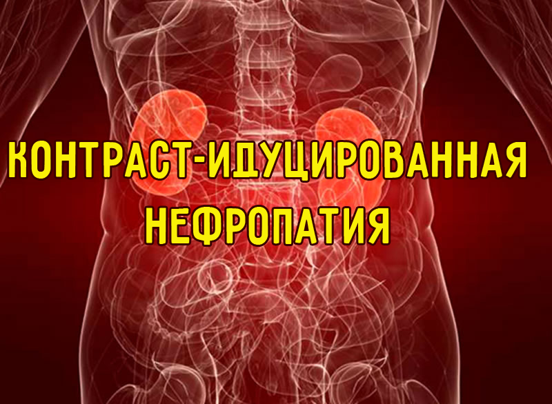 Контраст-индуцированная нефропатия Контраст-индуцированная нефропатия