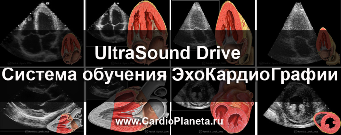 UltraSound Drive. Система обучения эхокардиографии UltraSound Drive. Система обучения эхокардиографии