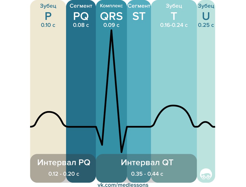 Интервалы P-QRS-T Интервалы P-QRS-T